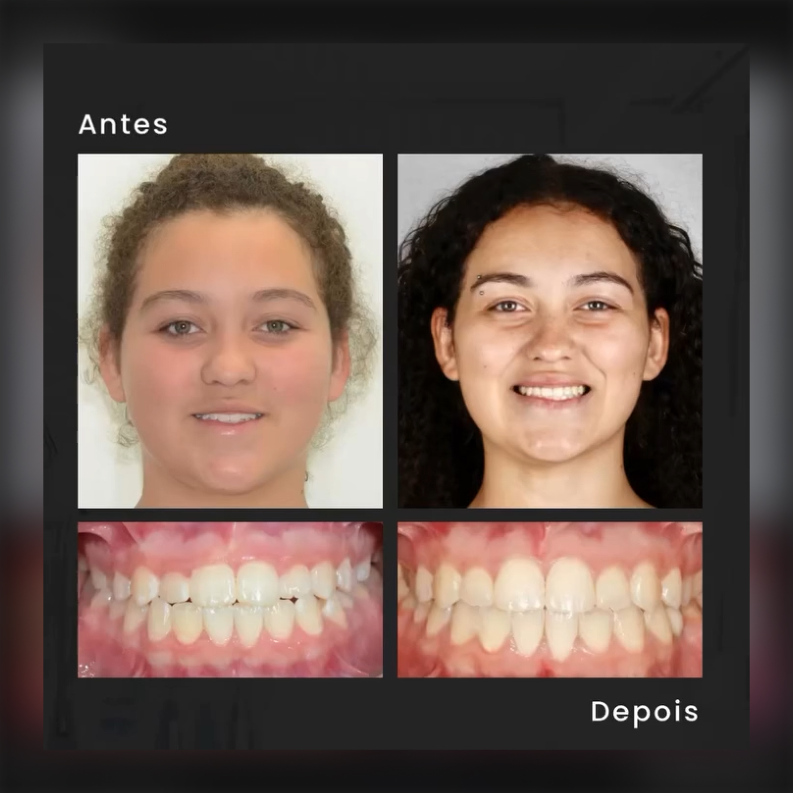 Depoimento
