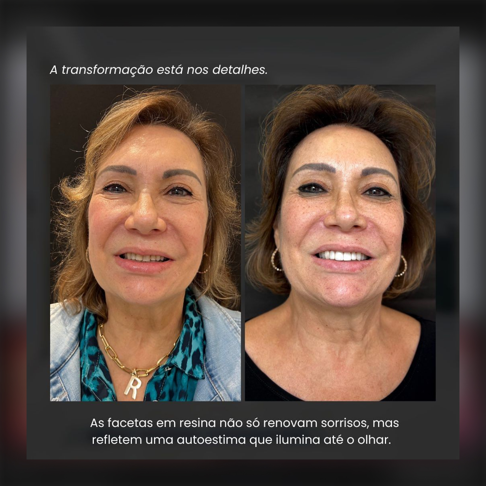 Depoimento