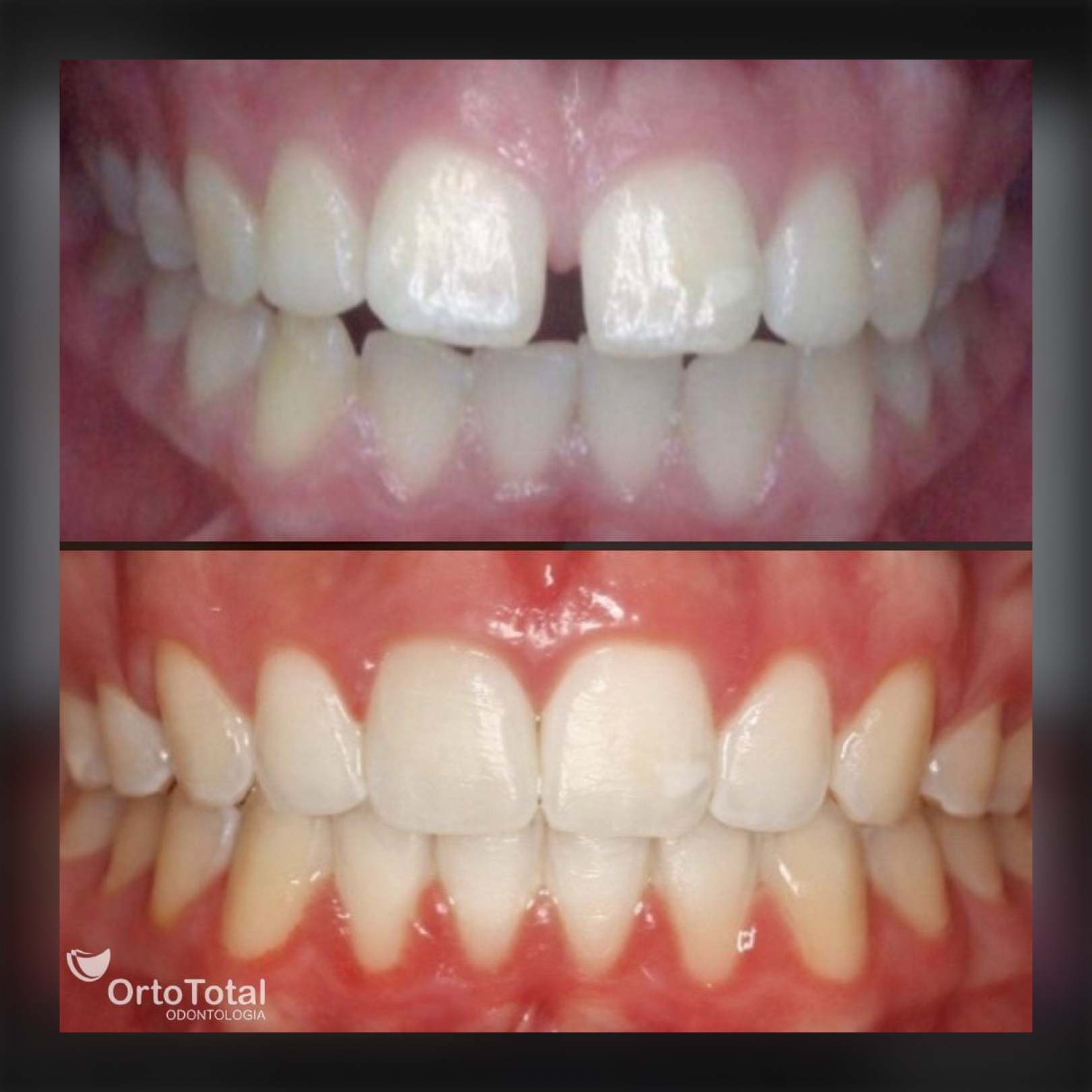 Depoimento