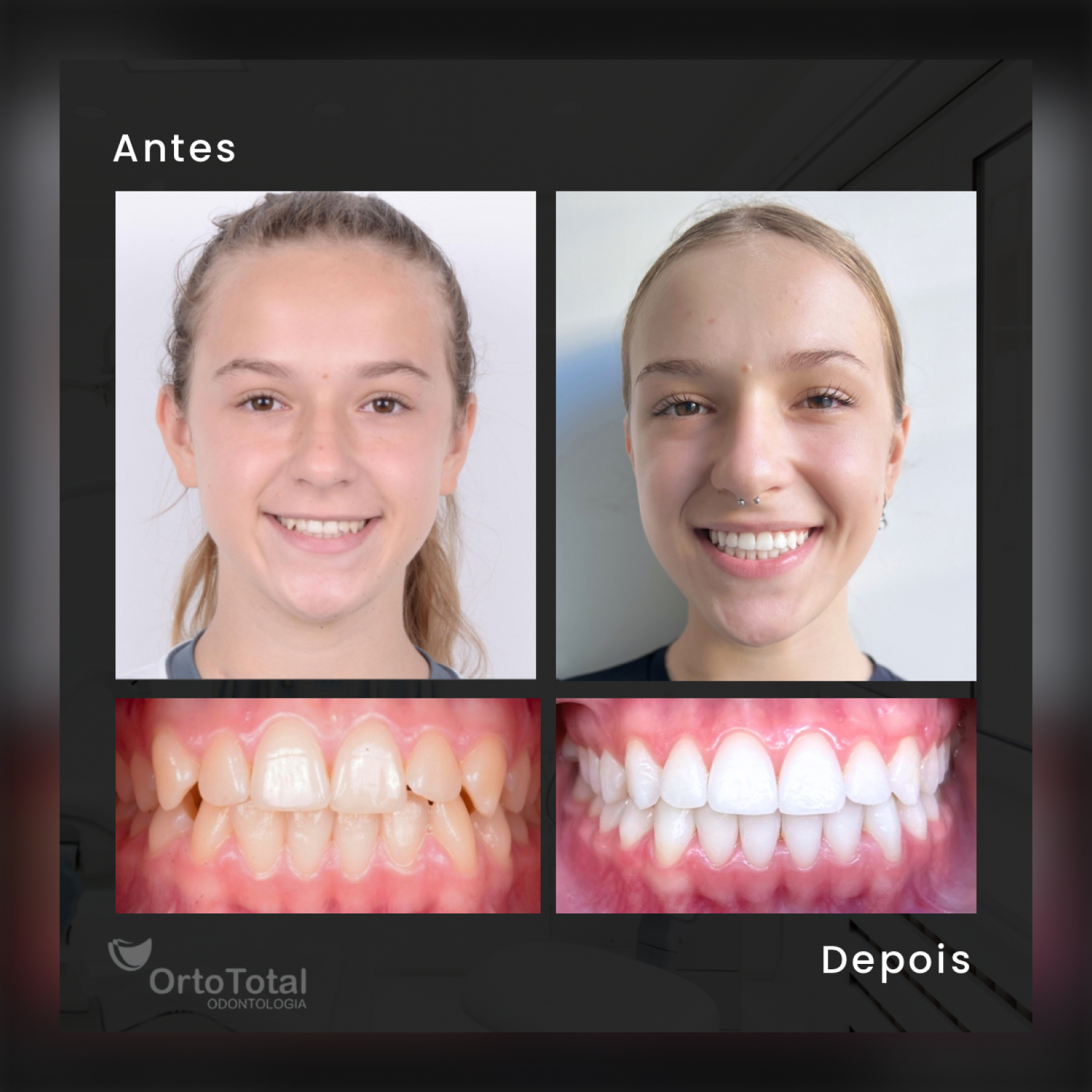 Depoimento