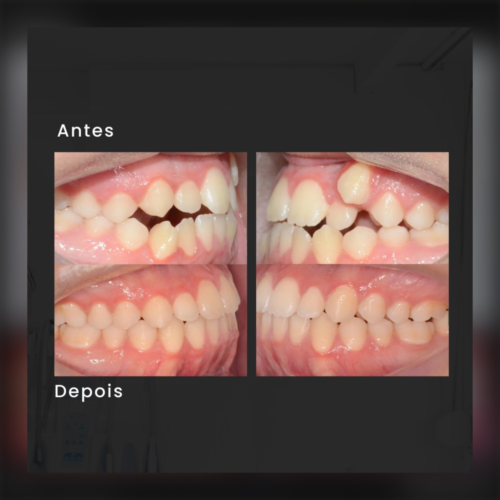 Depoimento