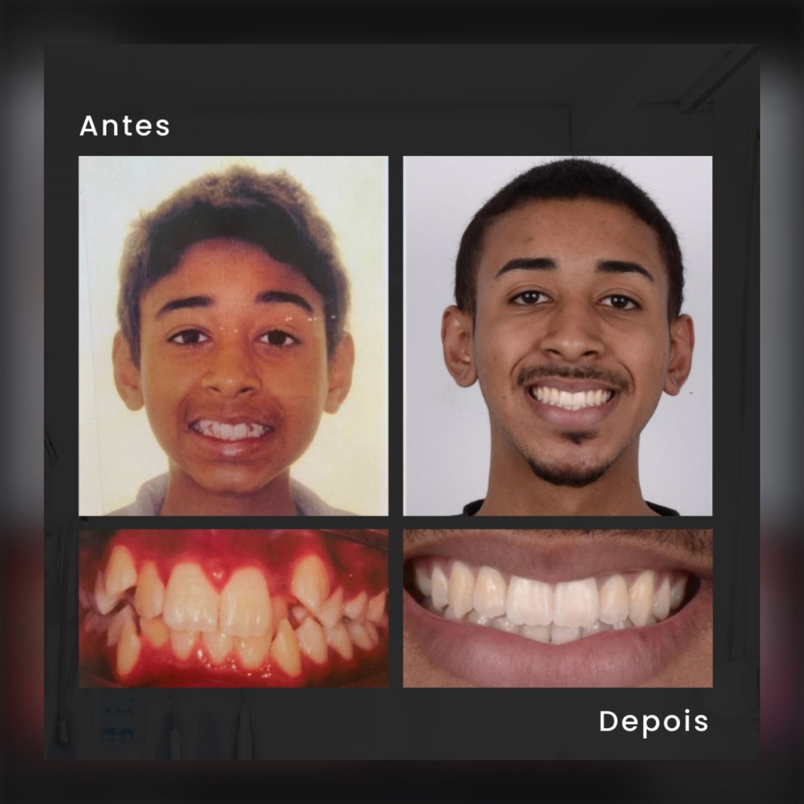 Depoimento