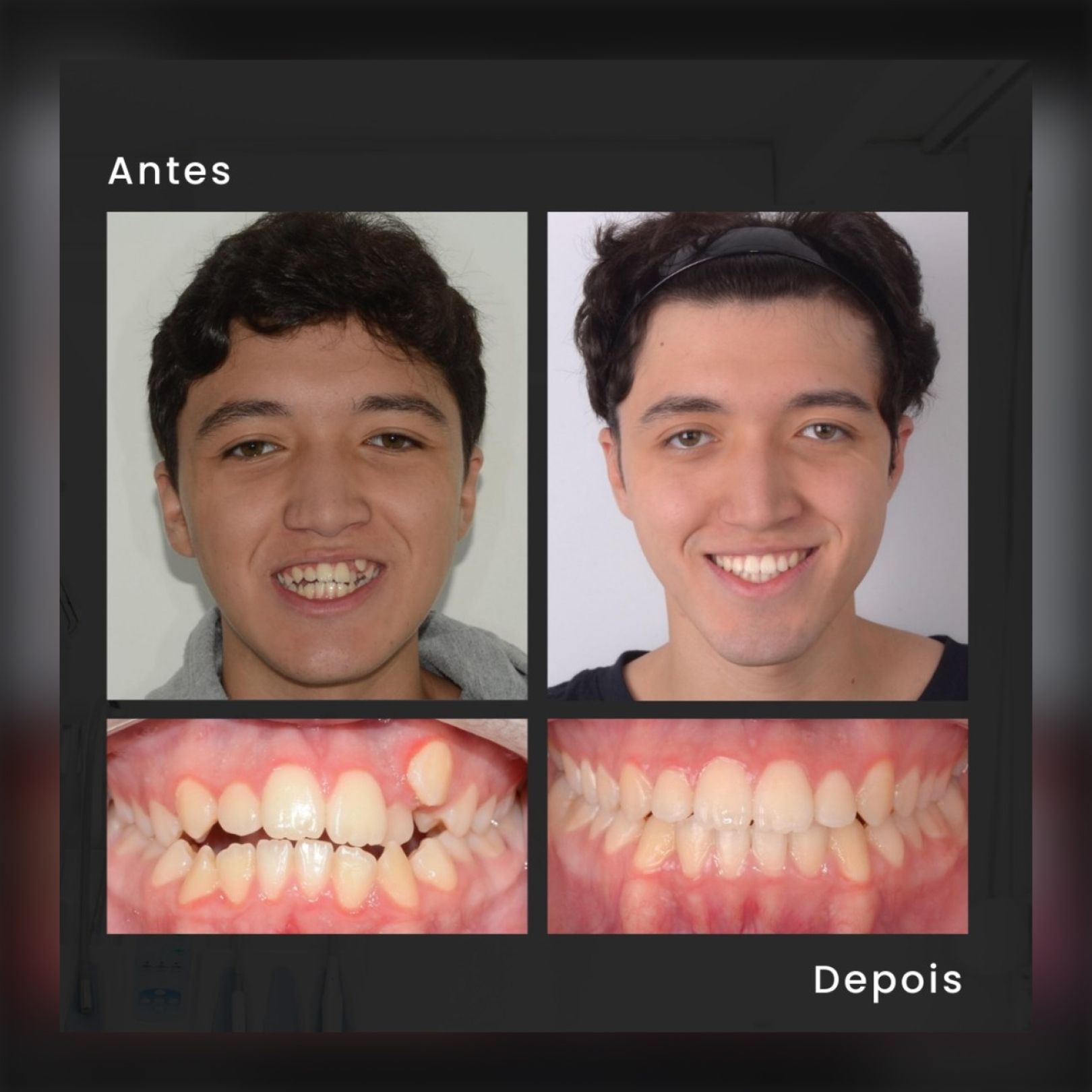 Depoimento