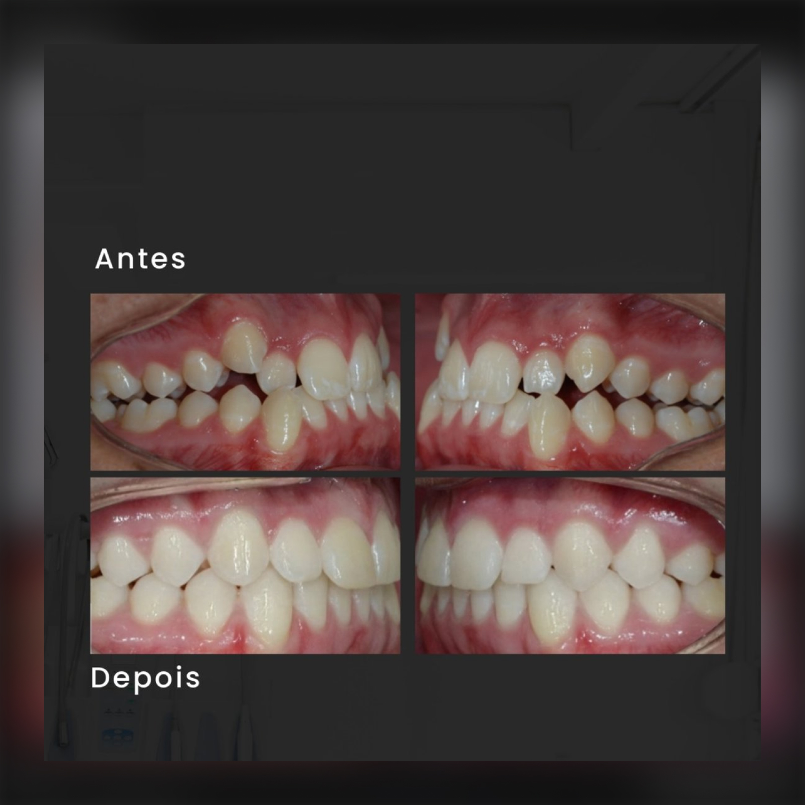 Depoimento