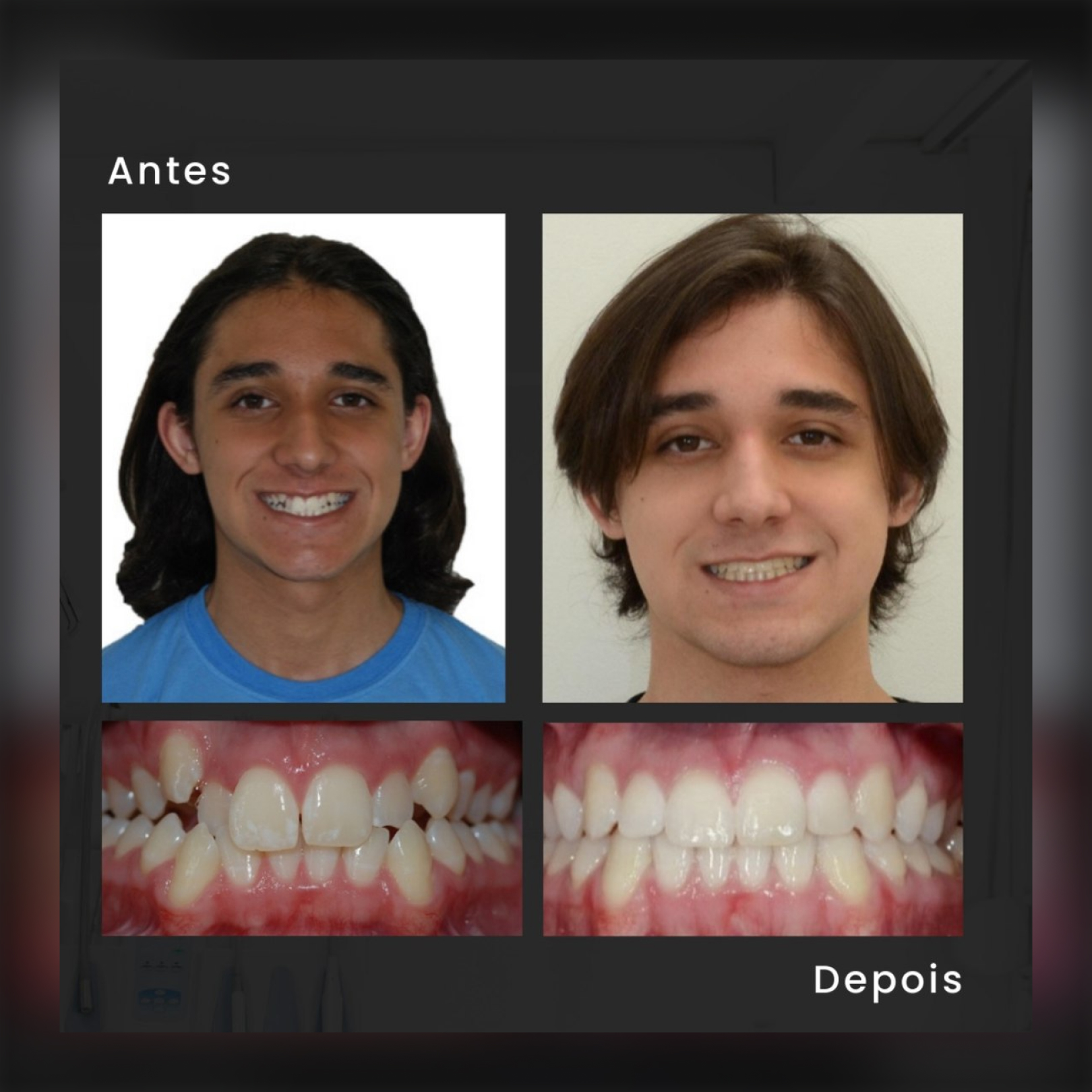 Depoimento