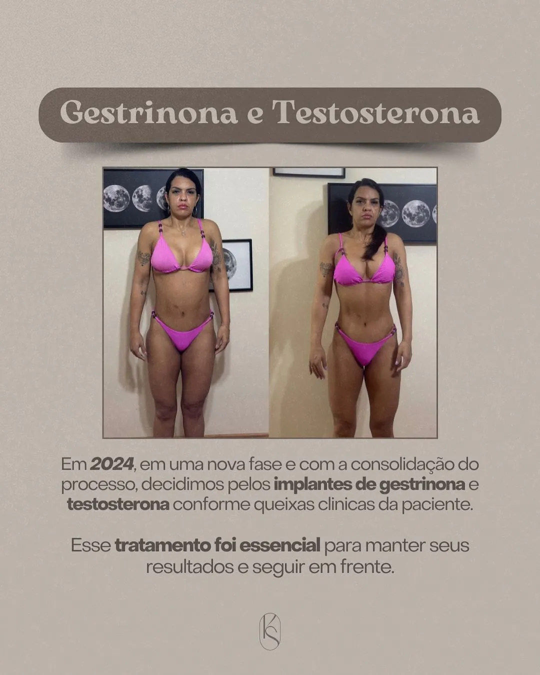 história da Fernanda