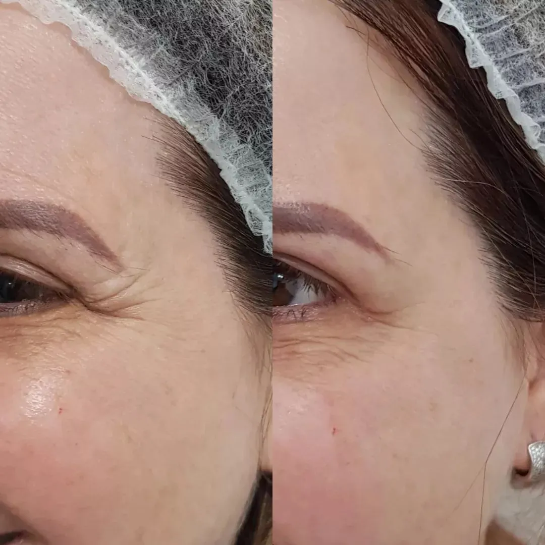 Depoimento
