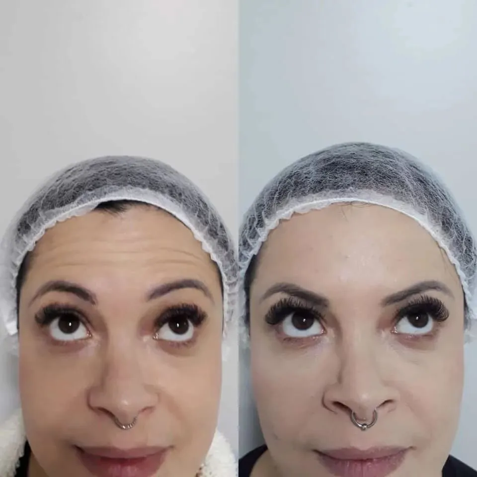 Depoimento
