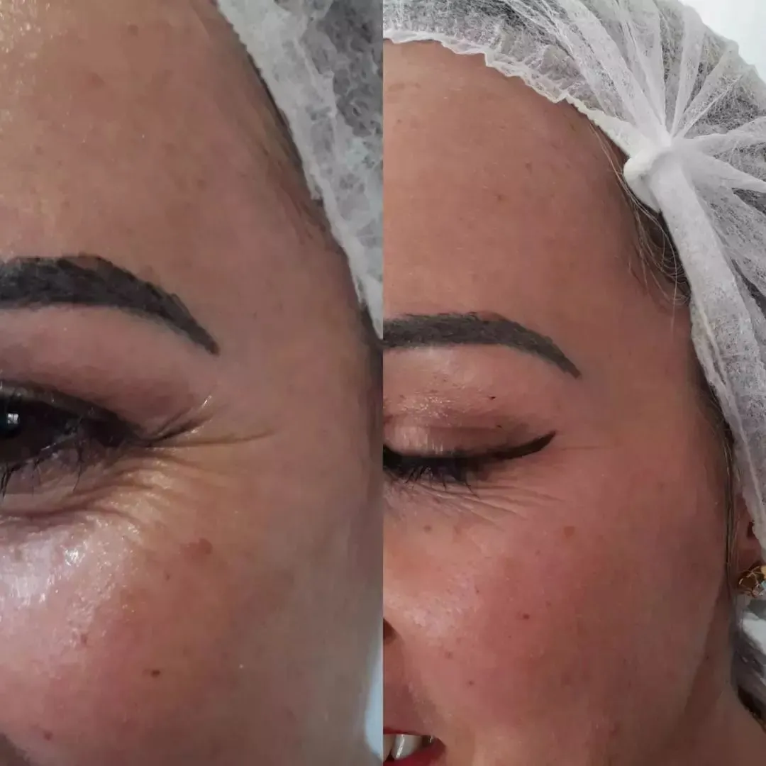 Depoimento