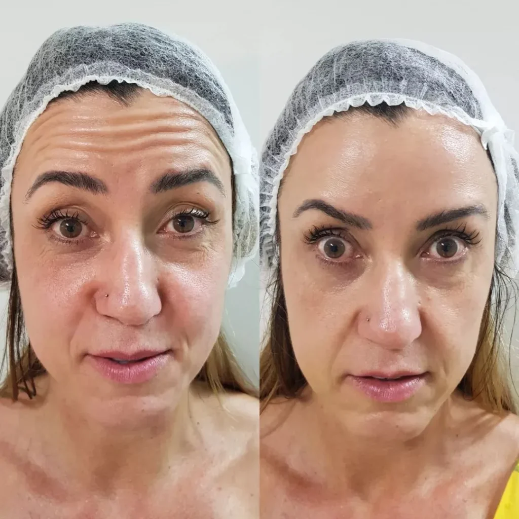 Depoimento