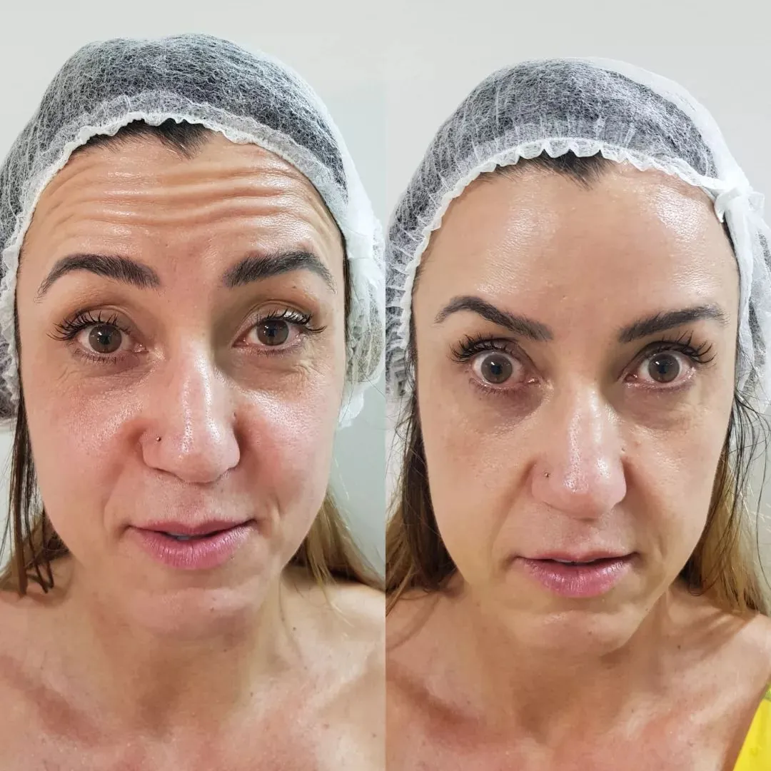 Depoimento