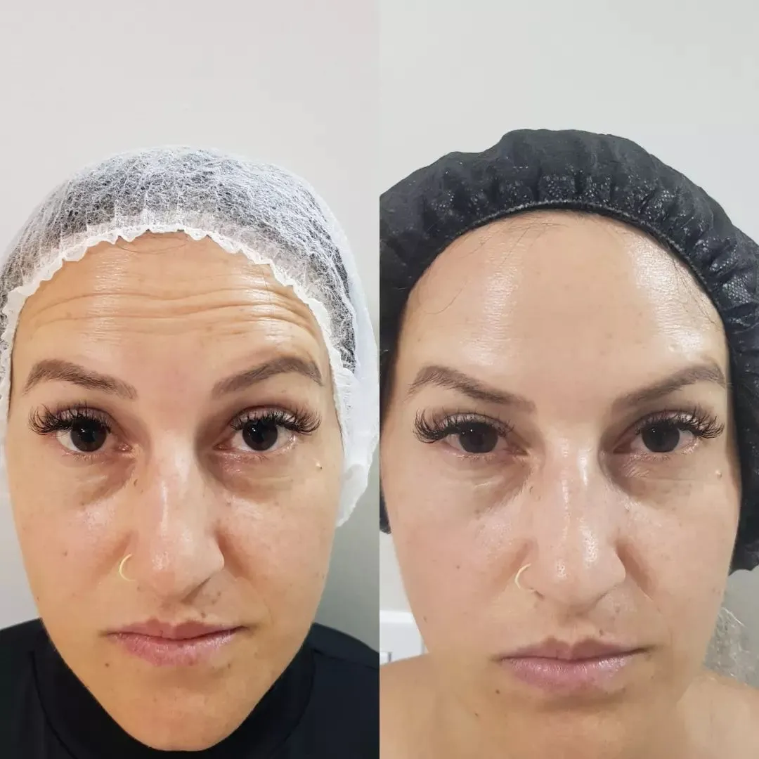 Depoimento