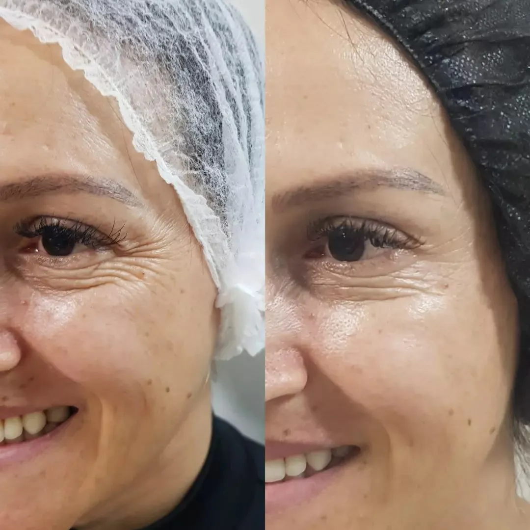 Depoimento
