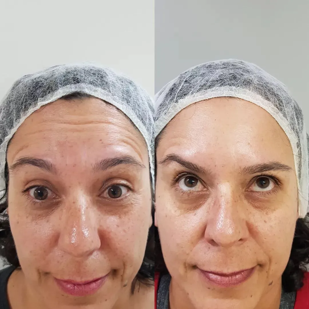 Depoimento