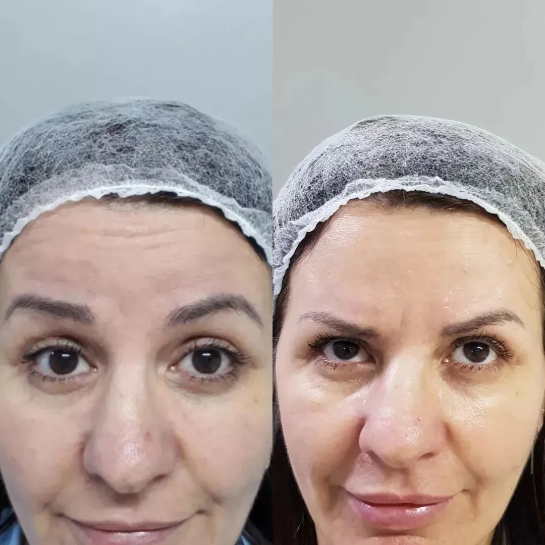 Depoimento