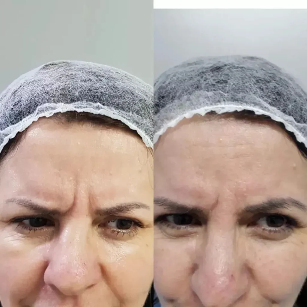 Depoimento