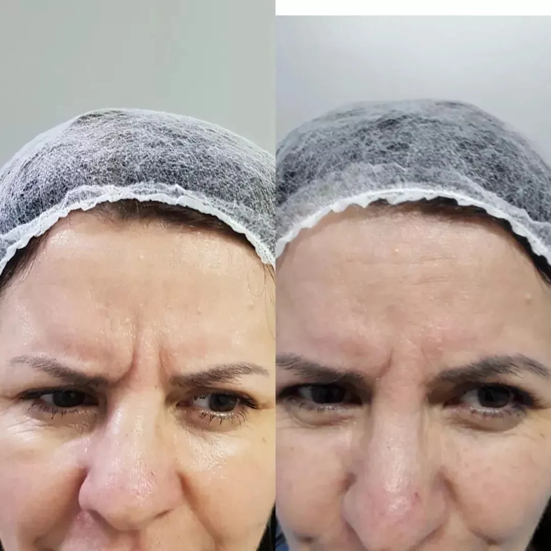 Depoimento