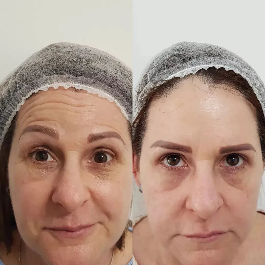 Depoimento