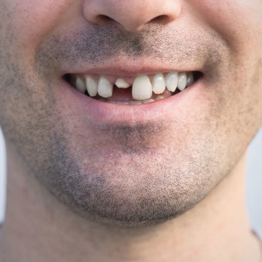 Insatisfação com o sorriso