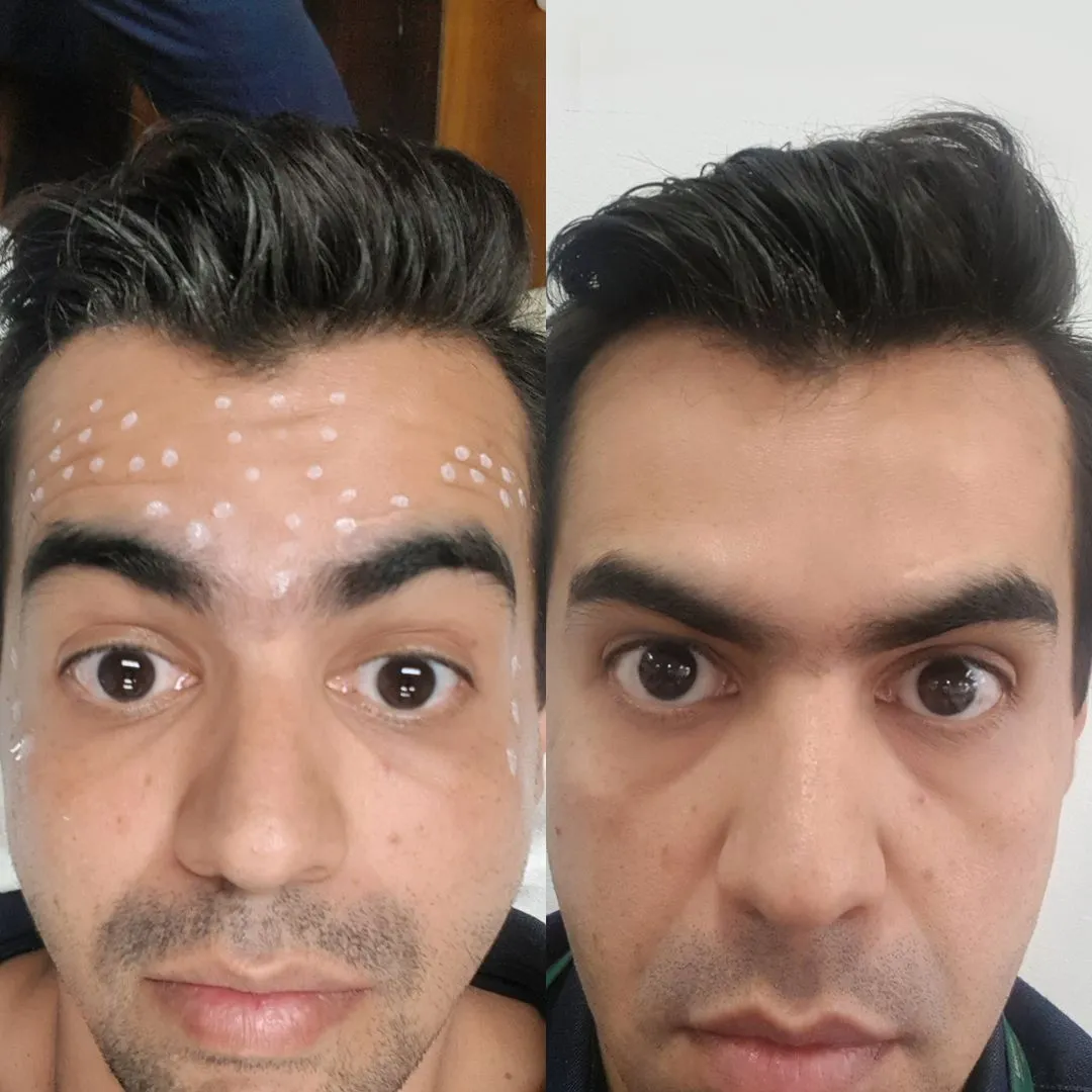Depoimento