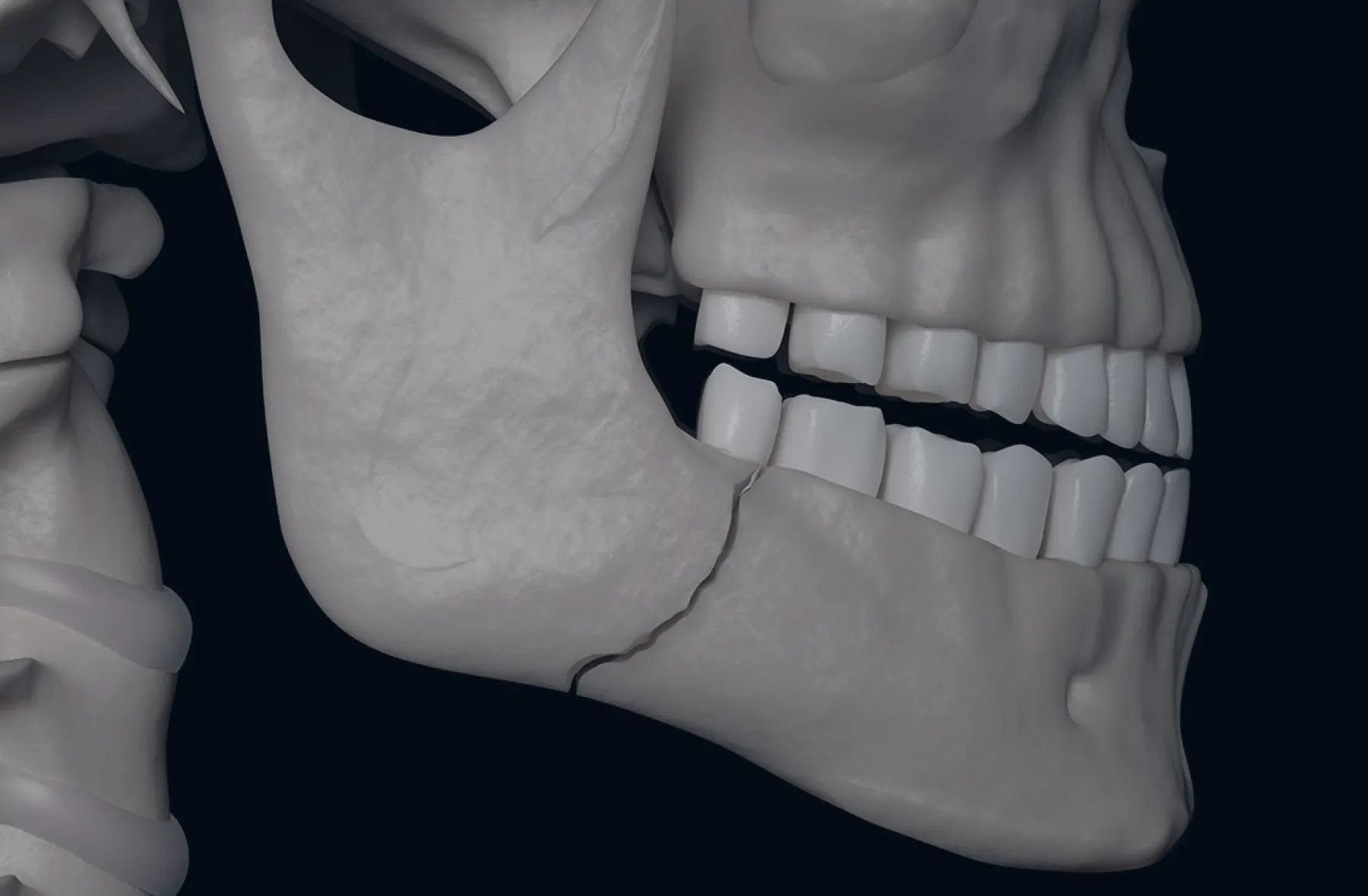 Bucomaxilofacial