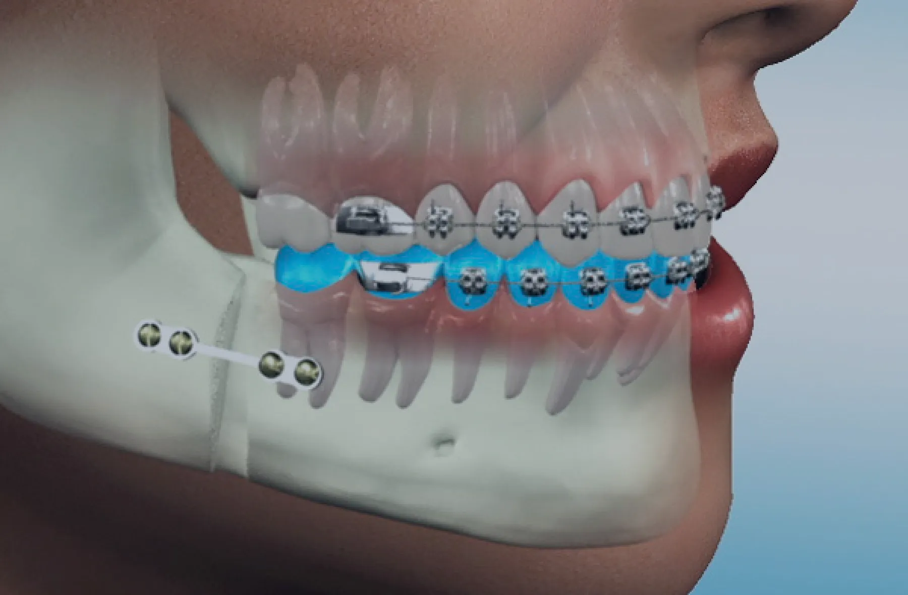 Oral-Maxillofacial-Surgery