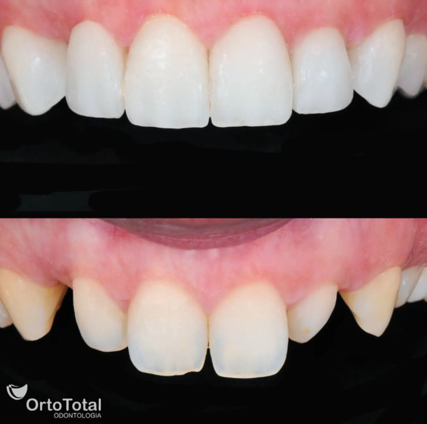 Depoimentos Ortototal